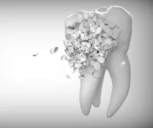 Smile Dental Clinic: Tooth Fracture in a dental emergency 800x450 Dentist Dr. Ana Fusu Dr. Fusu