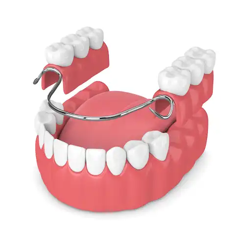 Smile Dental Clinic: Partial Dentures Dentist Dr. Ana Fusu Dr. Fusu