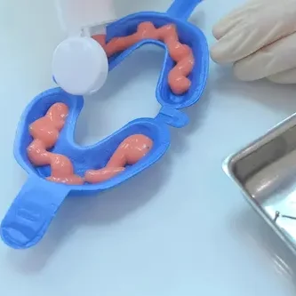 Smile Dental Clinic: Fluoride Treatment Dentist Dr. Ana Fusu Dr. Fusu