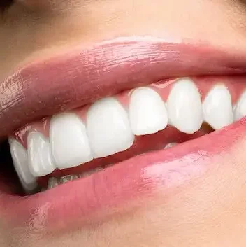 Smile Dental Clinic: Teeth Whitening Dentist Dr. Ana Fusu Dr. Fusu